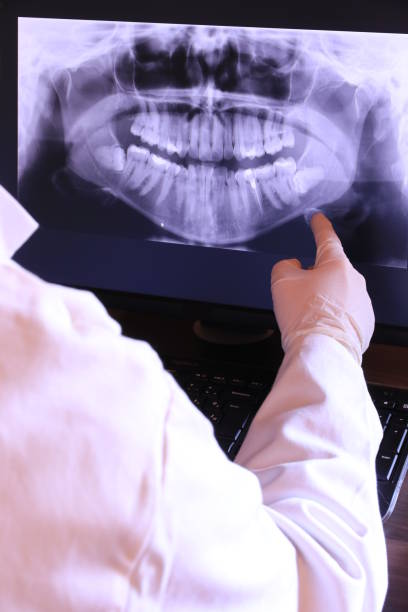 Best Urgent Dental Care for Toothaches in Canton, NC